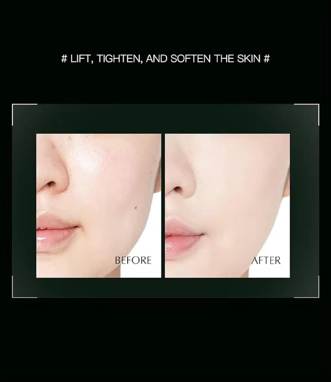 Sereneglow SkinLift™ Anti-aging Tool